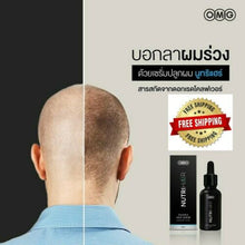 Load image into Gallery viewer, NUTRIHAIR SERUM Regrowth Essence Growth Strong Hair Loss Treatments