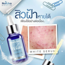 Load image into Gallery viewer, 50X Natcha White Serum Brighten Skin Reduce Dark Spots Acne Melasma Freckle Wrinkles