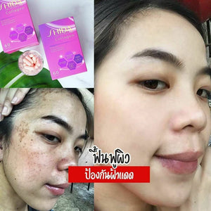 4X Shida Collagen HACP Gluta Q10 Whitening Skin Reduce Wrinkles Dark Spots Bright