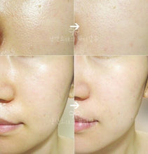 Load image into Gallery viewer, Smooth E Acne Scar Serum 7 G. Reduce Scar Dark Spot