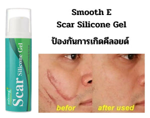Smooth E Scar Silicone Gel 10 g