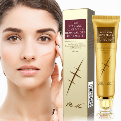 30g Acne Scar Removal Cream Pimples Stretch Marks Face Gel Remove Acne Smoothing Whitening Moisturizing Body Skin Care Aichun