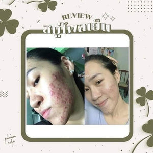 80g Natural Phaiyen Herbal Soap Deterring Acne Freckles Dark Spots Healthy Skin
