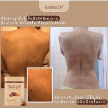 Load image into Gallery viewer, 3x Gluta All in one Anti Aging Reduce Acne Detox Toxin Healthy Smooth Aura Skin