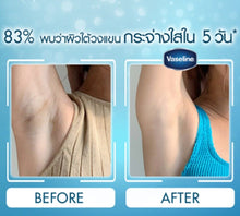 Load image into Gallery viewer, 6x Vaseline Deo Dry Serum Ultra Bright Deodorants Nourishing Moisturizer 45 ml