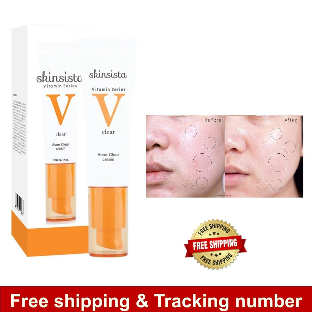 Skinsista V Acne Clear Cream Reduce Dark spots Redness Oil Control Vitamin 30ml