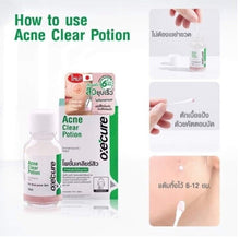 Load image into Gallery viewer, 3x Oxecure advantage acne spot Clear Potion Nourishing Sensitive Freshness Skin