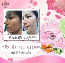 Load image into Gallery viewer, 3X NEW LYDIA Night Cream Whitening Brighten Reduce Dark Spot Acne Freckles Dull