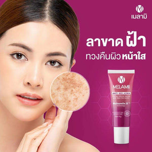 Melamii Anti-Melasma Melasma cream reduce blemishes reduce freckles Spot 8g