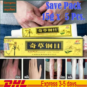 5x Gangmu Herbal Cream Eczema Fungus Ringworm Tinea Scald Itch Skin Care 15g