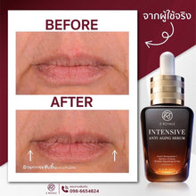 Load image into Gallery viewer, 4x Botox Serum 3Royale Intensive Anti-Aging Reduce Wrinkles lift V-Shape 10ml