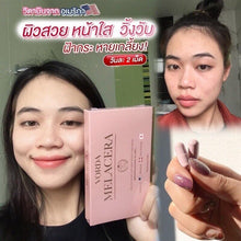 Load image into Gallery viewer, 5x Vorda Melacera Supplement Reduce Wrinkles Blemishes Freckles Skin Nutramin C