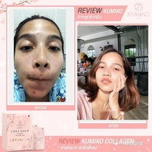 Load image into Gallery viewer, 10x KUMIKO Collagen Natural Ingredients Anti-Aging Skincare Smooth Radiance Skin