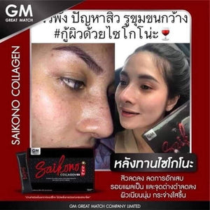 SAIKONO Fish Collagen Gluta Radiance Skin Reduce Wrinkles Antioxidants No Fat