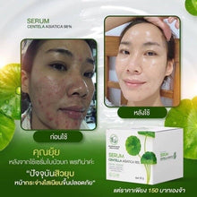 Load image into Gallery viewer, 6x30g Porntina Centella Asiatica Serum Moisturized Soothe Skin By Irritation