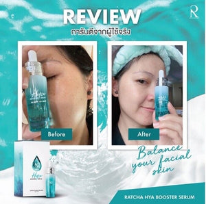 4 Set Face Serum Dark Spot Remover+ Vit C Whitening Anti Aging Wrinkles Freckle