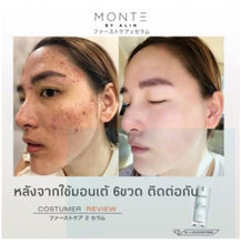 Load image into Gallery viewer, 3X Monte First 2Care Skin Serum Reduce Freckle Dark Spot Melasma Anti Aging Skin