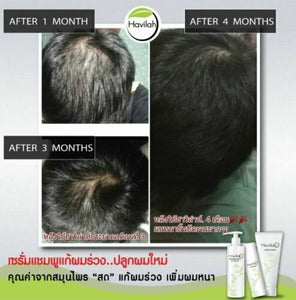 3Set Shampoo Conditioner Shampoo And Conditioner Tonic Hair alopecia tratamiento