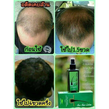 Load image into Gallery viewer, 6x120ml Green Wealth Neo Neo Hair Lotion Root Nutrients Treatments Hair Loss