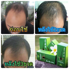 Load image into Gallery viewer, 4x 120ml Neo Hair Lotion Green Wealth Growth Root Nutrients Hair Loss Skin Hair