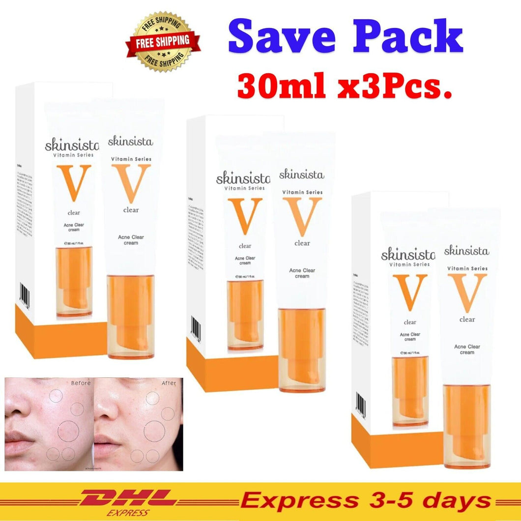 3x Skinsista V Acne Clear Cream Reduce Acne Dark spots Redness Oil Control DHL