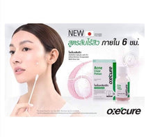 Load image into Gallery viewer, 3x Oxecure advantage acne spot Clear Potion Nourishing Sensitive Freshness Skin