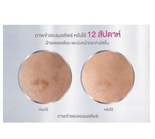 Load image into Gallery viewer, 5X BEST NIVEA Luminous630 Spot Clear Nourishing Reducing Dark Spot freckles 30ml