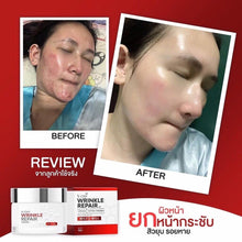 Load image into Gallery viewer, 6 Set V-CHY Winkle Repair Cream &amp; Serum Skin Bouncing Tight Firm Aura Skin