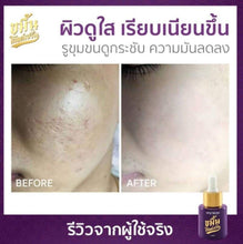 Load image into Gallery viewer, 3x NEW ViV Skin Kamin Gold Serum Skin Brightening Reduce Acne Dark Spot Wrinkles