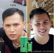 Load image into Gallery viewer, Neo Hair Lotion Root Treatment Nutrients Sideburns Longer Herb 120ml