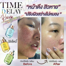Load image into Gallery viewer, Time Delay Double C Booster Serum Reduce Blemishes Freckles Dark Spots Acne Skin