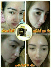 Load image into Gallery viewer, B&#39;Secret Wild HoneyCream whitening Nourish And Heal dark spot corrector wrinkles