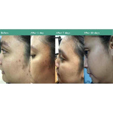Load image into Gallery viewer, 4 Bottles Mfeel Serum Spongilla Micro Skin Repair Rejuvenating Problems