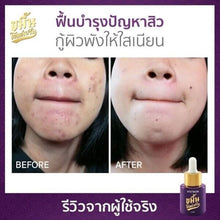 Load image into Gallery viewer, 3x NEW ViV Skin Kamin Gold Serum Skin Brightening Reduce Acne Dark Spot Wrinkles